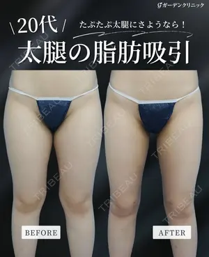 null days after image