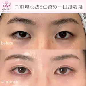 120 days after image