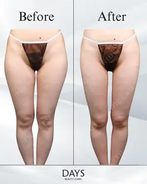 null days after image