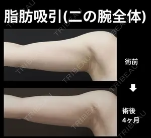 30 days after image