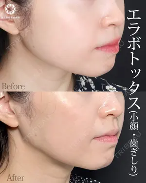 null days after image