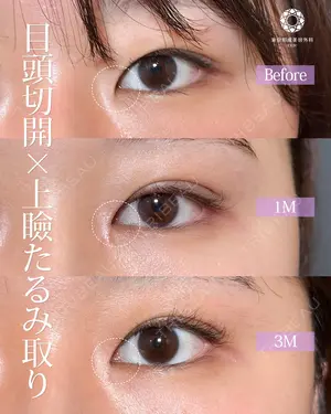 null days after image