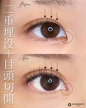 null days after image