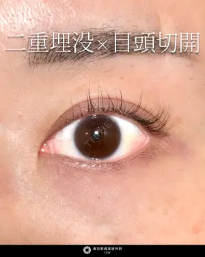 null days after image