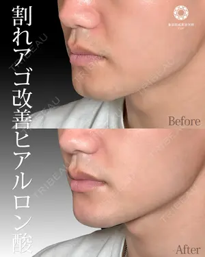 null days after image