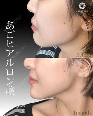 null days after image