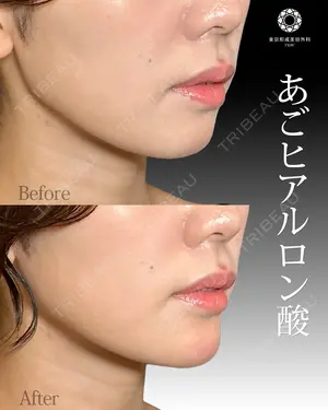 null days after image