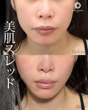 null days after image