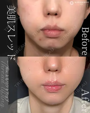 null days after image