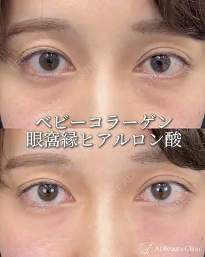 null days after image