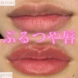 null days after image