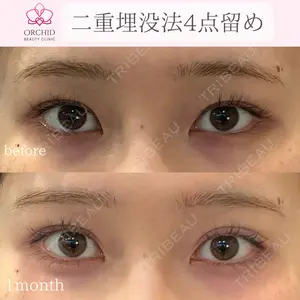 30 days after image