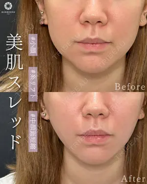 null days after image