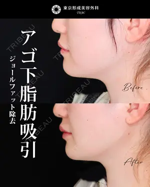 null days after image