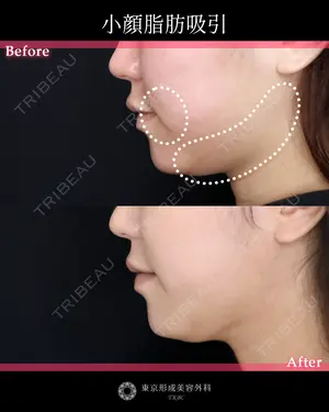 null days after image