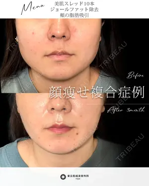 null days after image