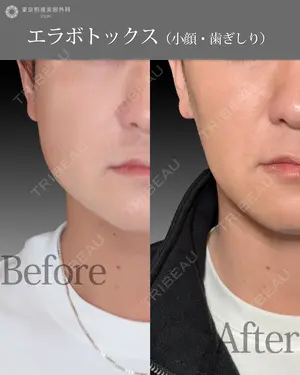 null days after image