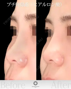 null days after image