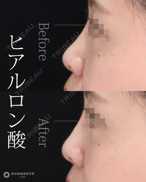 null days after image