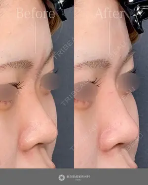 null days after image