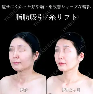 null days after image