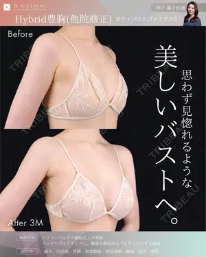 null days after image