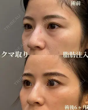 180 days after image