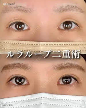 null days after image