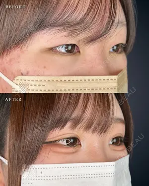 null days after image