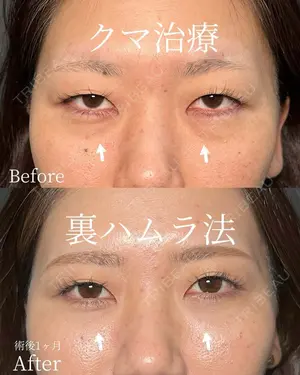 null days after image