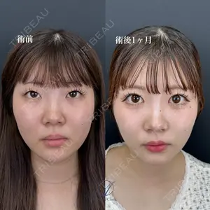 null days after image