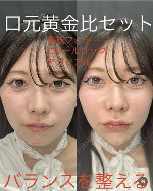 null days after image