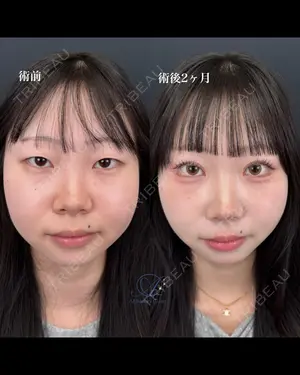 null days after image