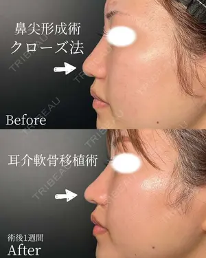 null days after image