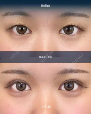 null days after image