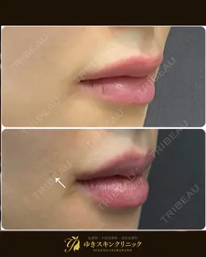 null days after image