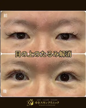 null days after image