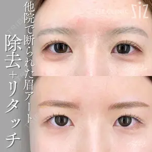 null days after image