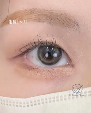 null days after image