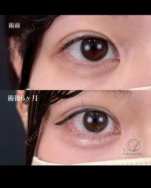 null days after image