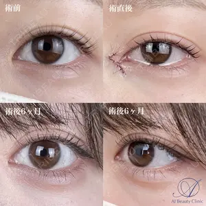 null days after image