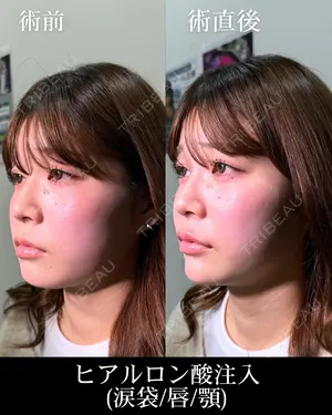 null days after image