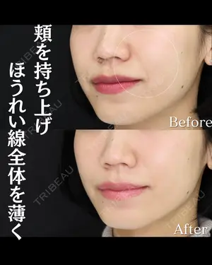 null days after image