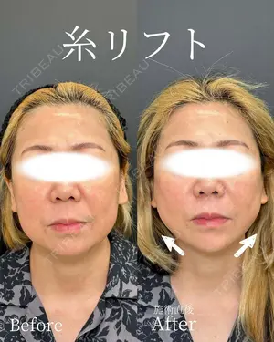 null days after image