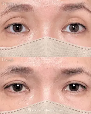 null days after image