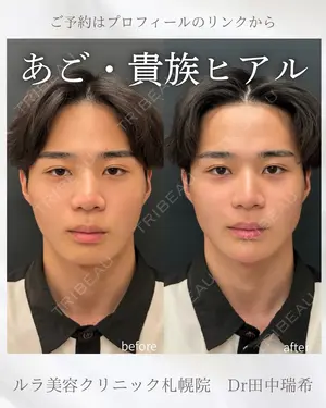 null days after image