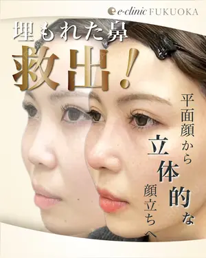 null days after image