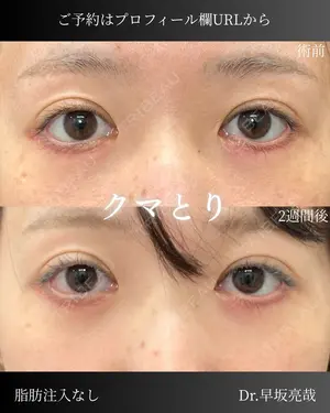 null days after image