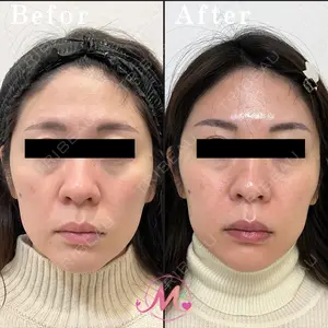 30 days after image