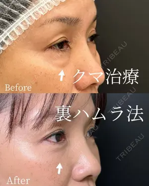 null days after image